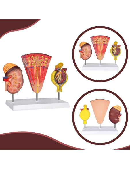 Modelo Anatómico de Riñón 3-en-1 Simedutech para Estudio