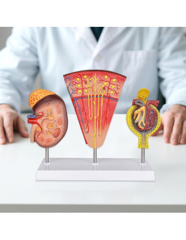 Modelo Anatómico de Riñón 3-en-1 Simedutech para Estudio