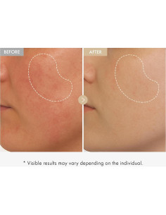 Sérum Facial TOSOWOONG de Arroz Real 33ml - Niacinamida y Alfa-Arbutina 2