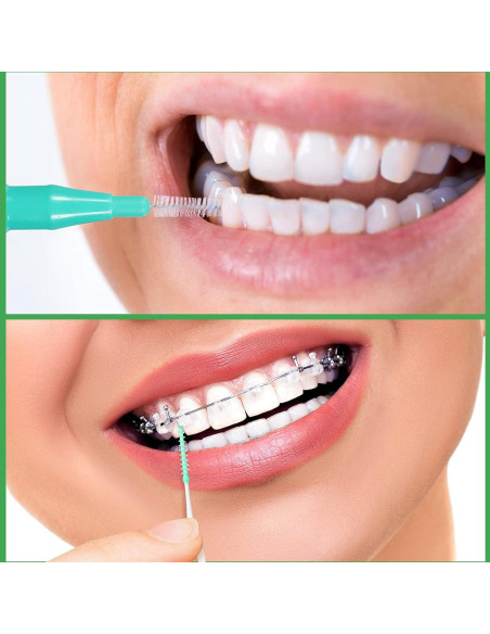 350 Piezas Cepillos Interdentales Patelai Hilo Dental Color Mezclado