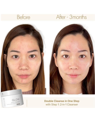 Kit de Cuidado de la Piel Mini Rxcue 3 Pasos Viaje 240g