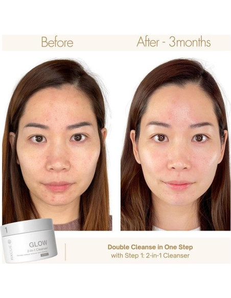 Kit de Cuidado de la Piel Mini Rxcue 3 Pasos Viaje 240g