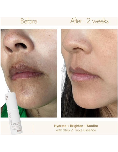 Kit de Cuidado de la Piel Mini Rxcue 3 Pasos Viaje 240g