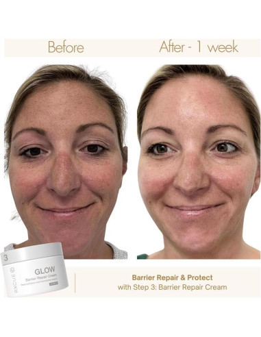 Kit de Cuidado de la Piel Mini Rxcue 3 Pasos Viaje 240g