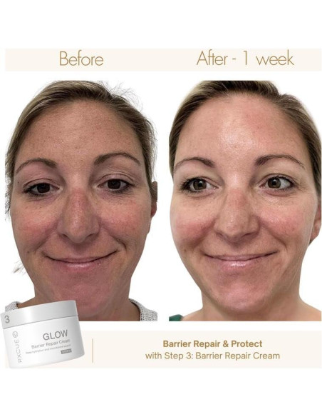 Kit de Cuidado de la Piel Mini Rxcue 3 Pasos Viaje 240g