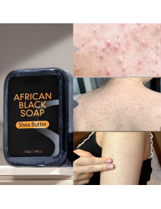 Jabón Negro Africano en Barra 4 Unidades - Manteca de Karité 2