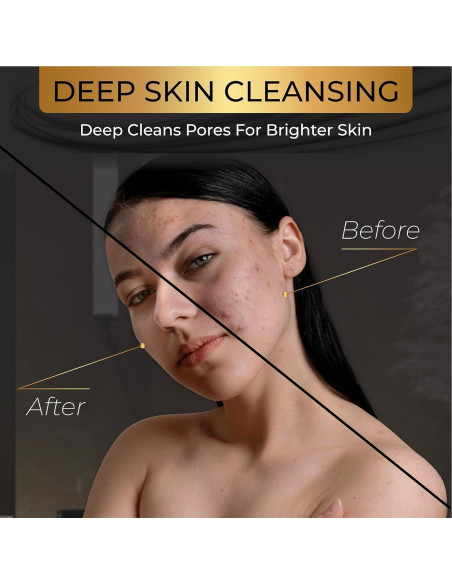 Conjunto de Jabones de Carbón Natural AMVital - 3 Piezas Veganas