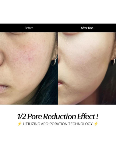 Set de Cuidado de Piel CELORABY Glow - Dispositivo 5-en-1 y Almohadillas