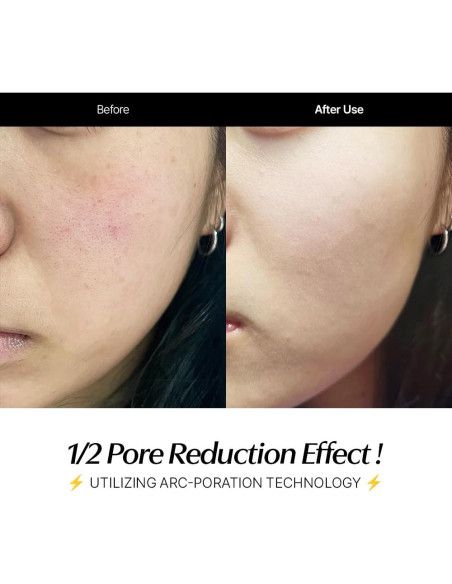 Set de Cuidado de Piel CELORABY Glow - Dispositivo 5-en-1 y Almohadillas