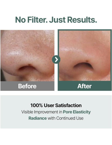 CELORABY Almohadillas de Tónico Coreano con Exosomas y Ácido Hialurónico - 70 Unidades