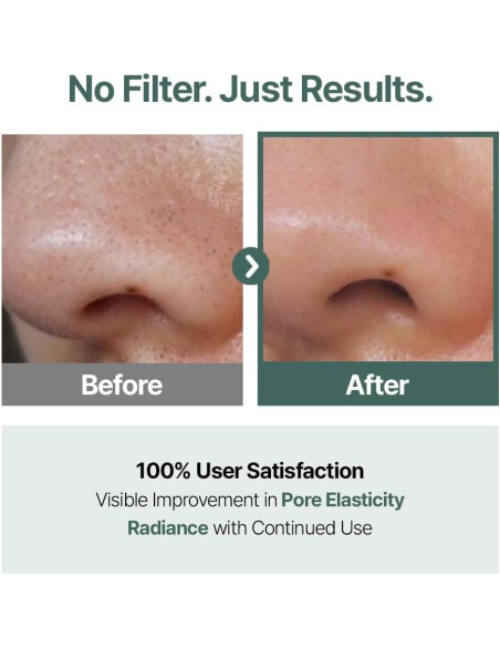 CELORABY Almohadillas de Tónico Coreano con Exosomas y Ácido Hialurónico - 70 Unidades