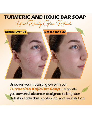 Jabón de Cúrcuma Kojic Balemalik 150g - Unifica Tono Piel