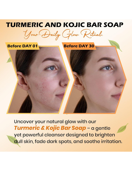 Jabón de Cúrcuma Kojic Balemalik 150g - Unifica Tono Piel