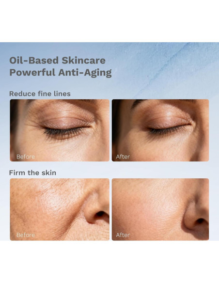 Cápsulas Renew APoEM Antienvejecimiento 60 Unidades