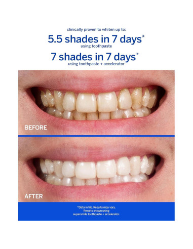 Kit Blanqueamiento Dental Supersmile - Pasta + Cepillo Seco