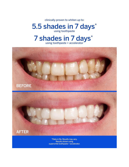 Kit Blanqueamiento Dental Supersmile - Pasta + Cepillo Seco