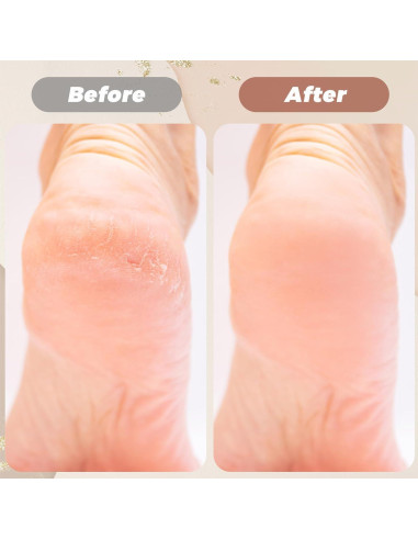 3 Pares de Calcetines Hidratantes para Talones Yuanan