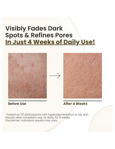 Aceite Facial Brillante Choglow 68g - Alternativa Natural al Retinol