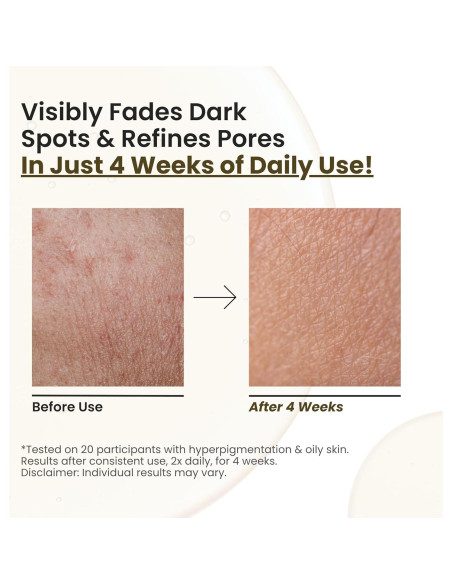 Aceite Facial Brillante Choglow 68g - Alternativa Natural al Retinol