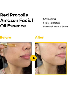 Esencia de Aceite Orgánico Propolis Rojo BBH 29.57 ml 2