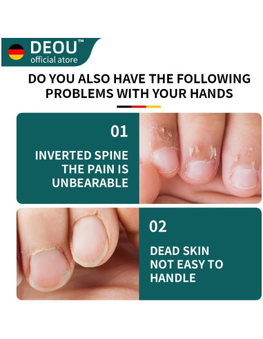 Tijeras de Cutícula DEOU Profesionales de Acero Inoxidable