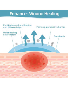 Vendaje de Hidrocoloide Dkmord 5.08cm x 2.01m para Heridas 2