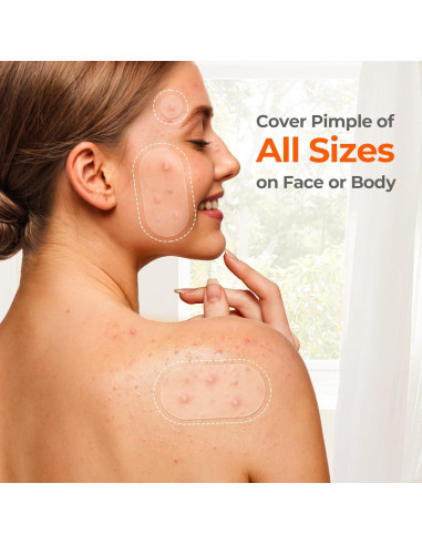 Parches para Acné TKTK Hidrocoloides 443 Piezas 5 Tamaños