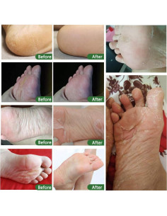 Mascarilla Exfoliante para Pies ALIVER - 5 Unidades Lavanda 2