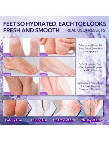 Máscara Exfoliante para Pies LANBENA Lavanda - 2 Pares