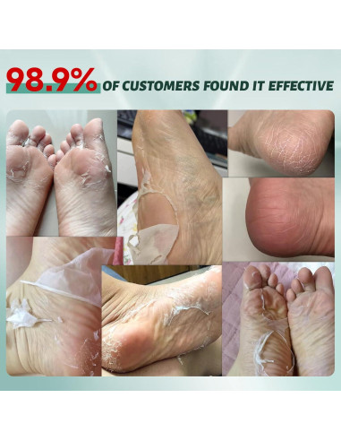 Máscara Exfoliante para Pies VGO - Paquete de 3 Unidades