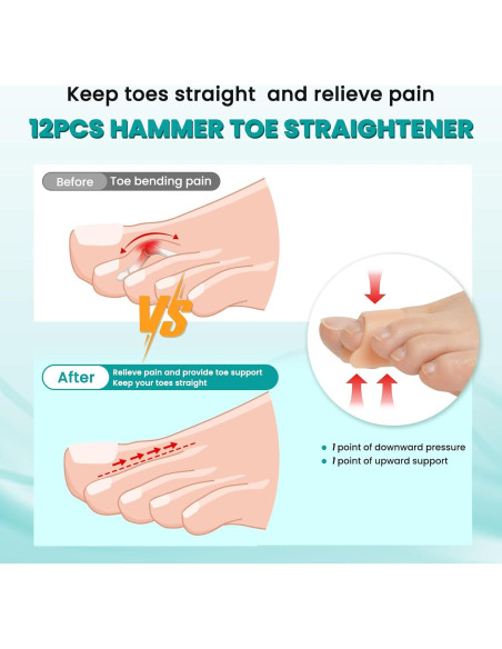 Corrector de Dedo en Martillo CEYOME - 12 Piezas Silicona