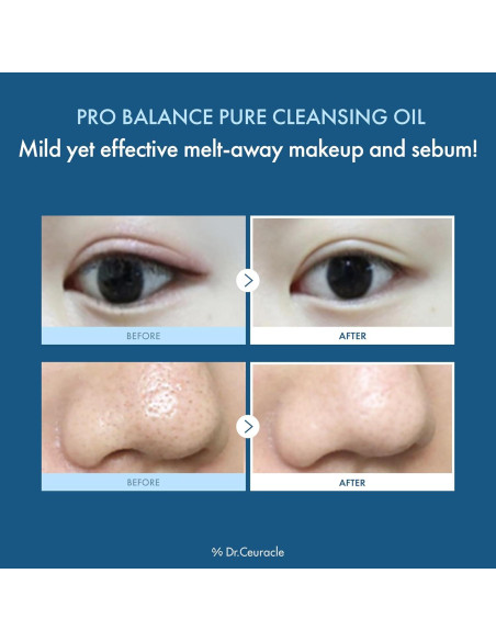 Aceite Limpiador Facial Dr.Ceuracle Pro Balance 155 ml