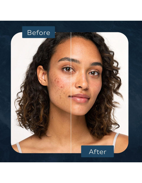 Limpiador Facial de Espuma NEPTUNE SKIN 120 ml - Natural y Suave