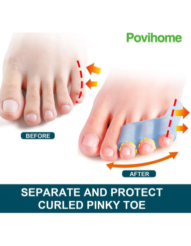 Separadores de Dedo Meñique Povihome 10 Piezas Alivio Dolor