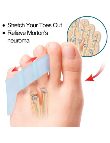 Separadores de Dedo Meñique Povihome 10 Piezas Alivio Dolor