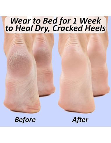 Calcetines Hidratantes Foot Medic para Talones Agrietados - Gel