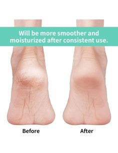 Calcetines Hidratantes Vaincre para Talones Agrietados - 4 Pares 2