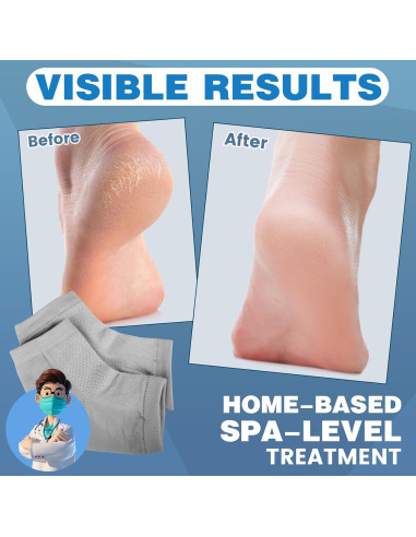 3 Pares de Calcetines Hidratantes TEAWOO para Talones Agrietados