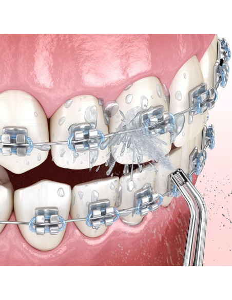 Consejos de Reemplazo ZACCER para Irrigador Bucal 8 Piezas