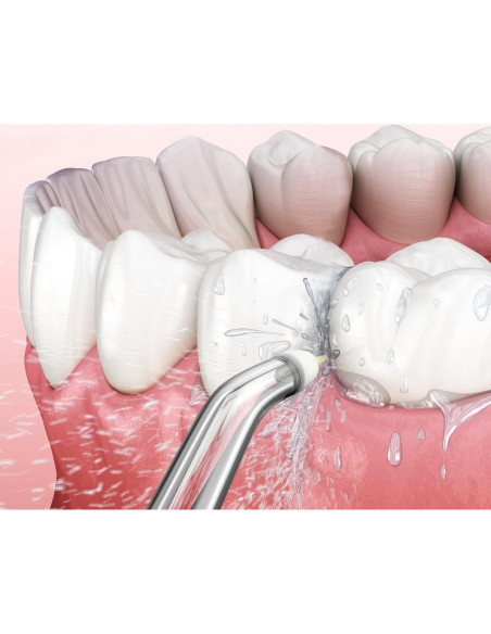 Consejos de Reemplazo ZACCER para Irrigador Bucal 8 Piezas