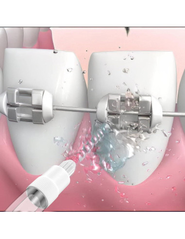 Consejos de Reemplazo ZACCER para Irrigador Bucal 8 Piezas