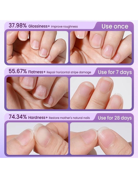 Bolígrafo 3-en-1 para Cutículas Shrandi - Cuidado de Uñas