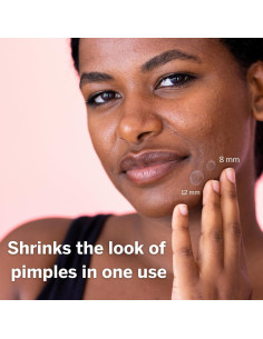 Parche Hidrocoloide para Granos Dot - 36 Unidades (8mm y 12mm) 2