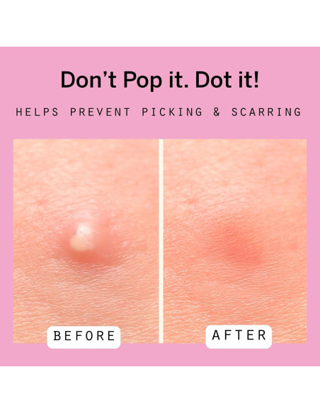 Parche Hidrocoloide para Granos Dot - 36 Unidades (8mm y 12mm)