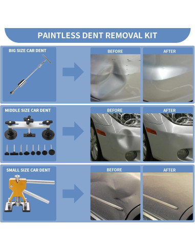 Kit de Extracción de Abolladuras NOENOUGH 97 Piezas