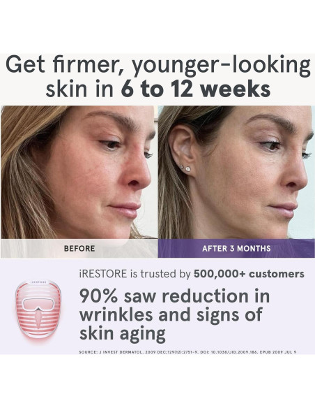 Máscara Facial LED iRestore | Terapia Luz Roja y Azul | 360 LEDs