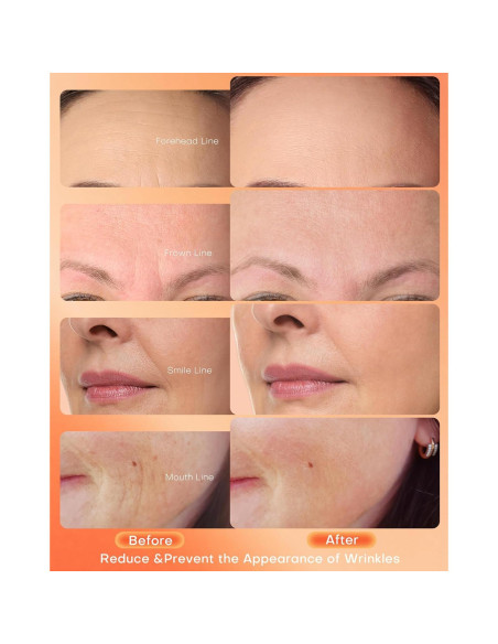 Máscara de Terapia de Luz Roja NEWKEY LED 7 Colores Facial Máscara de Terapia de Luz Roja NEWKEY LED 7 Colores Facial