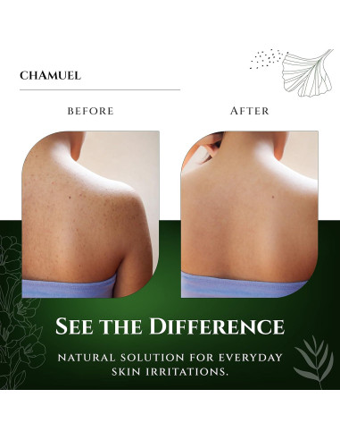 Jabón Corporal Natural Chamuel 335g - Árbol de Té