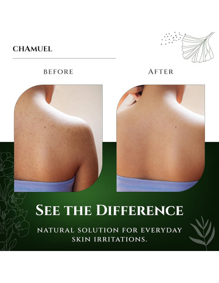 Jabón Corporal Natural Chamuel 335g - Árbol de Té Jabón Corporal Natural Chamuel 335g - Árbol de Té