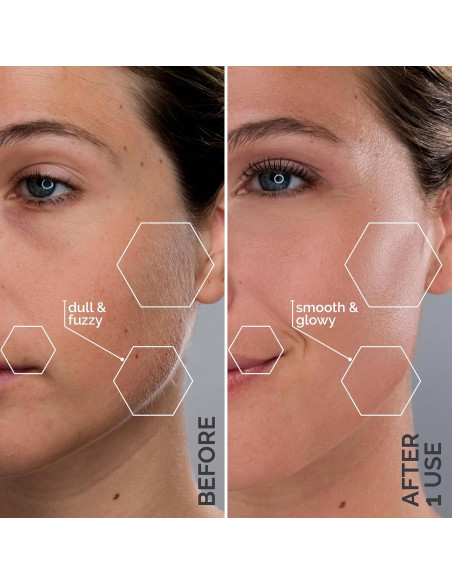 Afeitadora Dermaplane Spa Sciences SIMA Rosa 2-en-1 Exfoliación